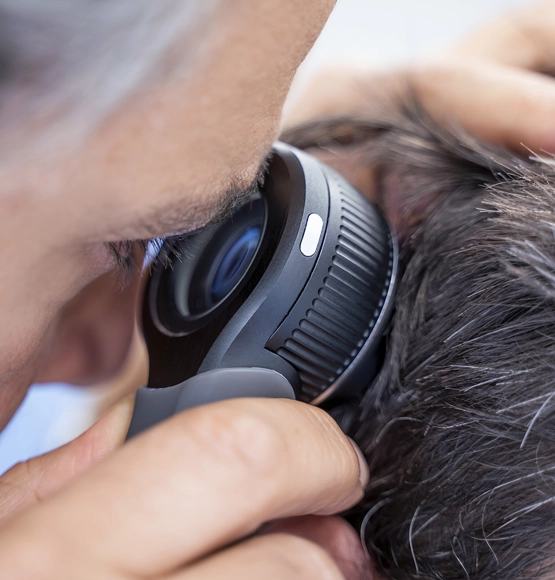 Hair Transplant Procedure