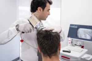 Latest Developments In Hair Transplantation