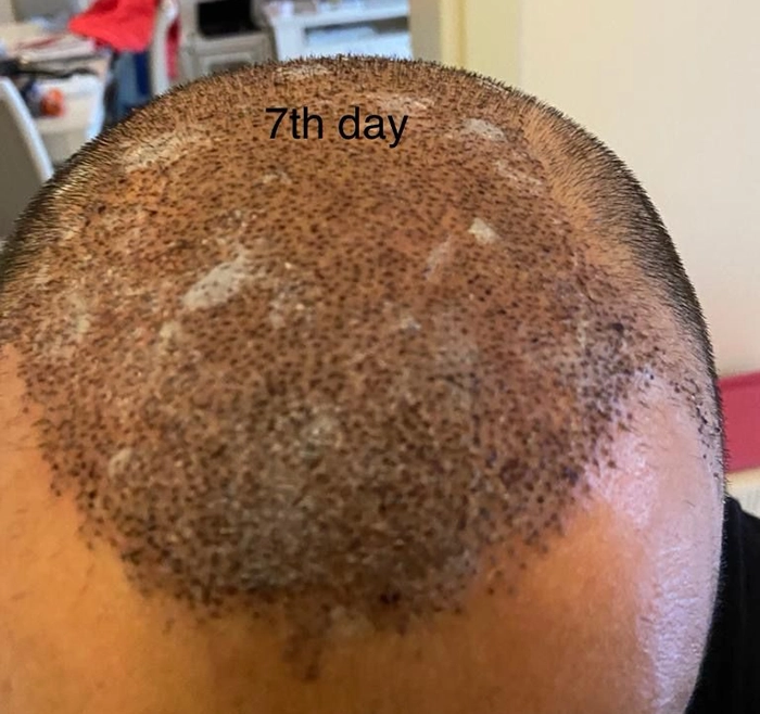 7th Day