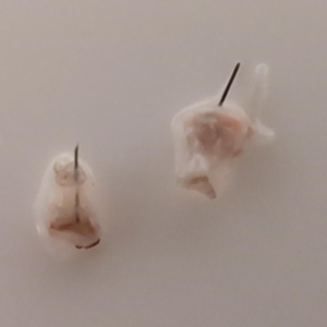 Hair Shafts Shedding With Crusts After Hair Transplant