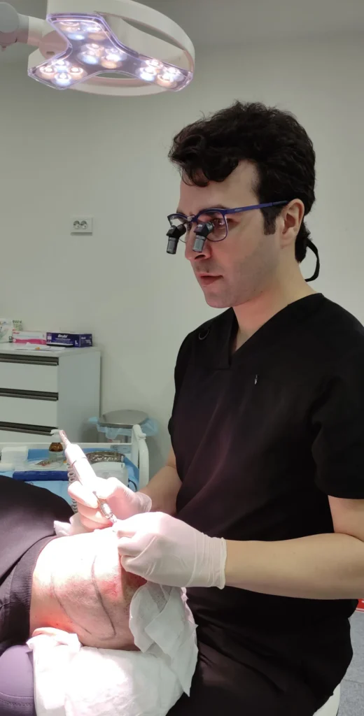 FUE Hair Transplant