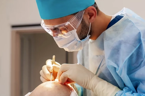 Body Hair Be Used for a Hair Transplant