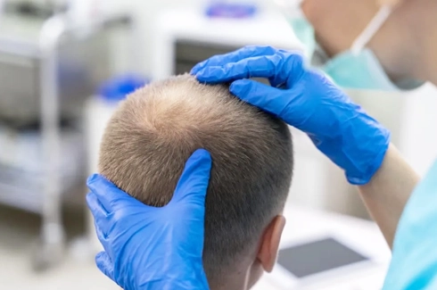 importance of the doctor consultation in hair transplant day