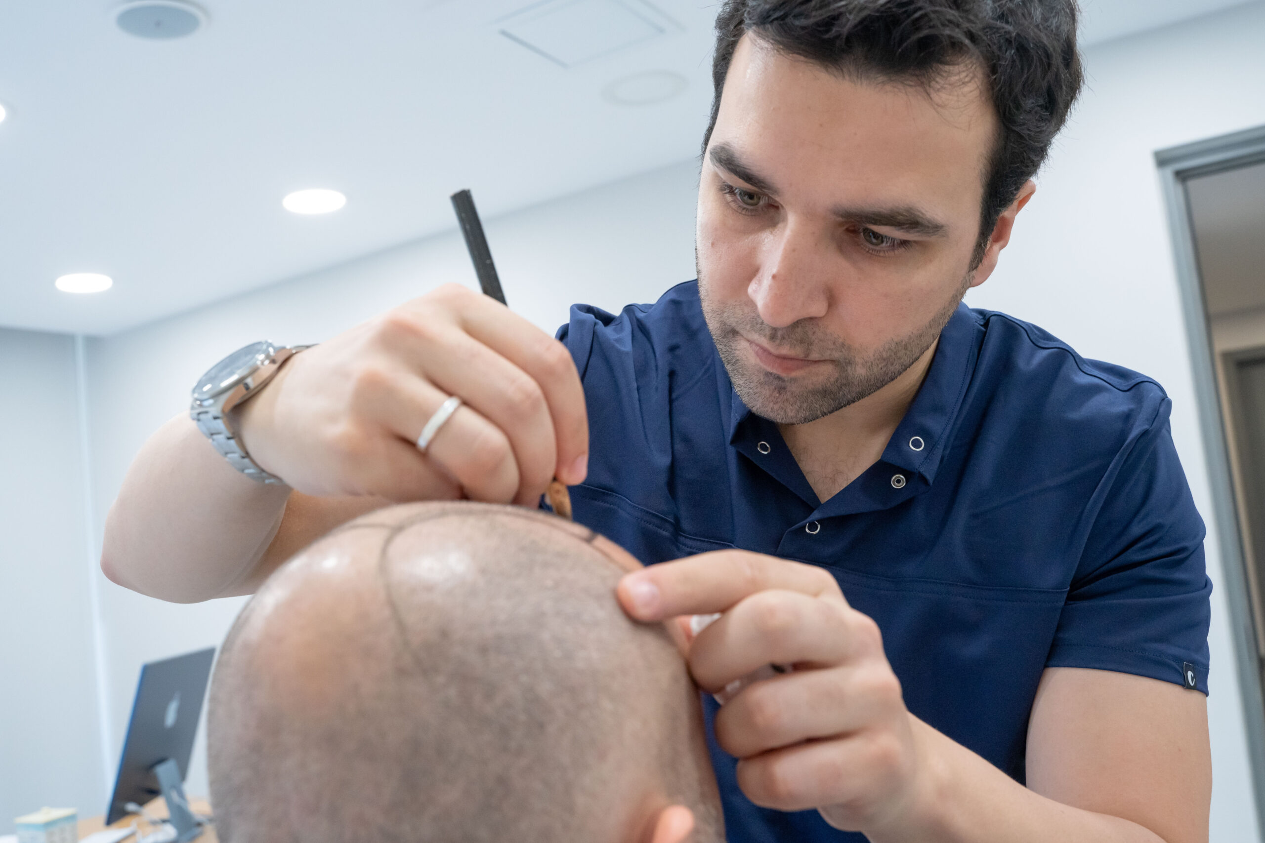 Step 2: Hairline Design and Operation Planning