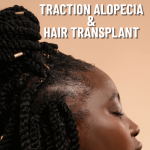 Traction Alopecia hair transplant