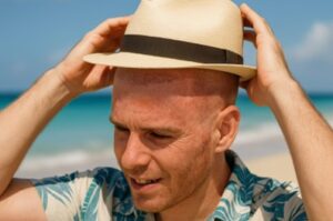 Summer Hair Transplant: patient wearing a hat to protect his transplanted hair from sun exposure