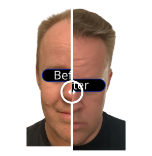 before_after