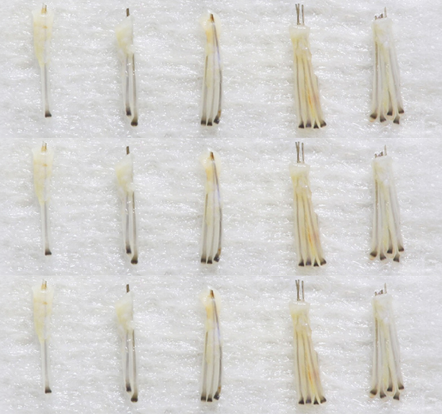 Graft vs Hair: Grafts containing 1-5 hair follicles