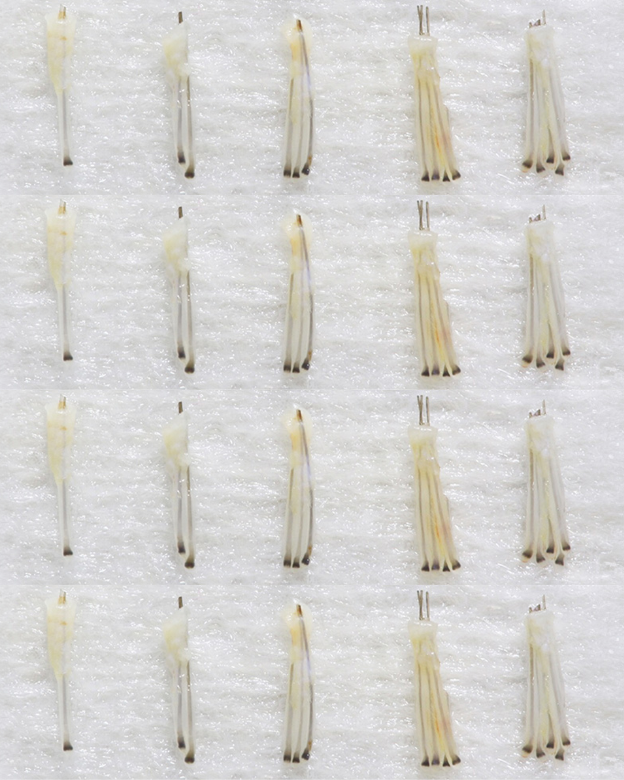 Graft vs Hair: Grafts containing 1-5 hair follicles