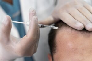Exosome Hair Therapy: Can It Enhance Your Hair Transplant Results?