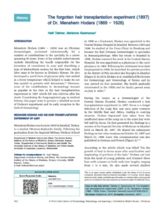 Modern Hair Surgery: Dr Menahem Hodara’s Hair Transplant Experiment