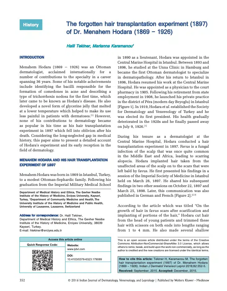 Modern Hair Surgery: Dr Menahem Hodara’s Hair Transplant Experiment