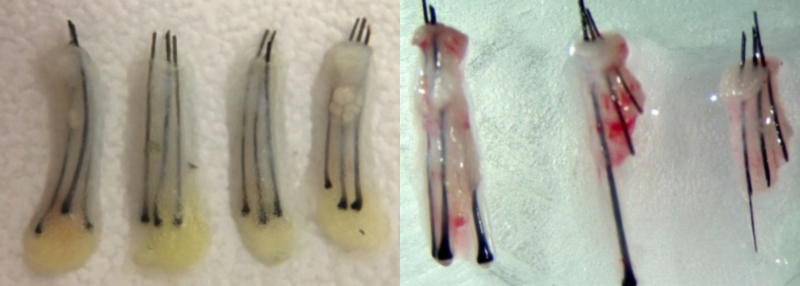 Alt Text: Failed Hair Transplants: Healthy & Transected Grafts
