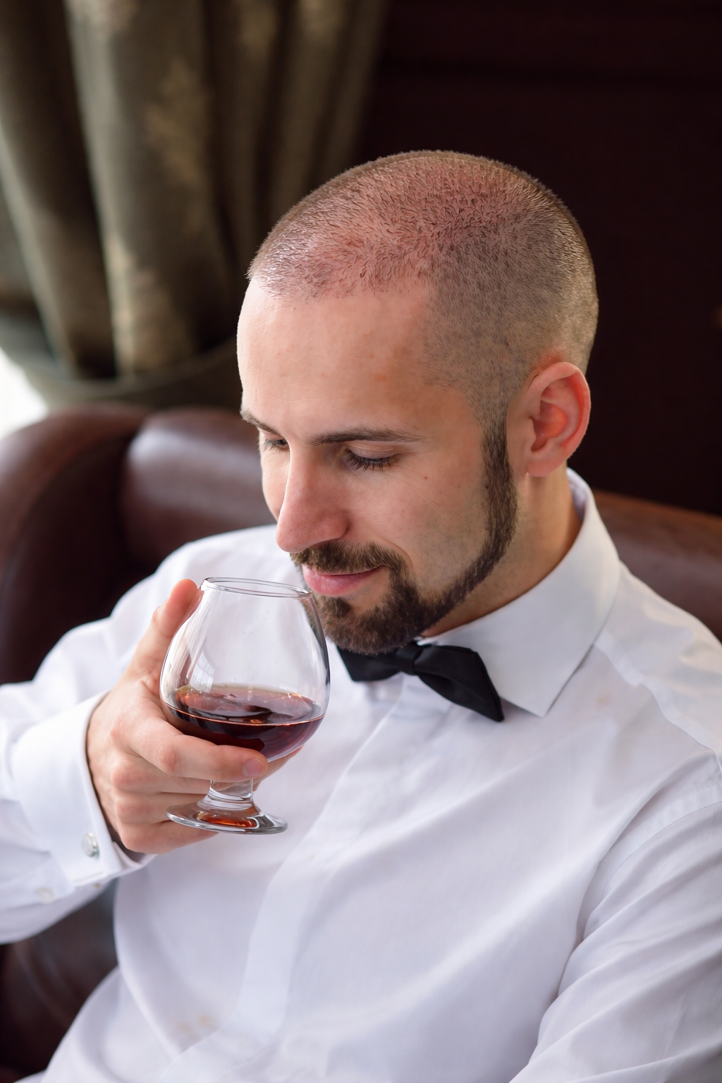 Alcohol and Hair Transplant