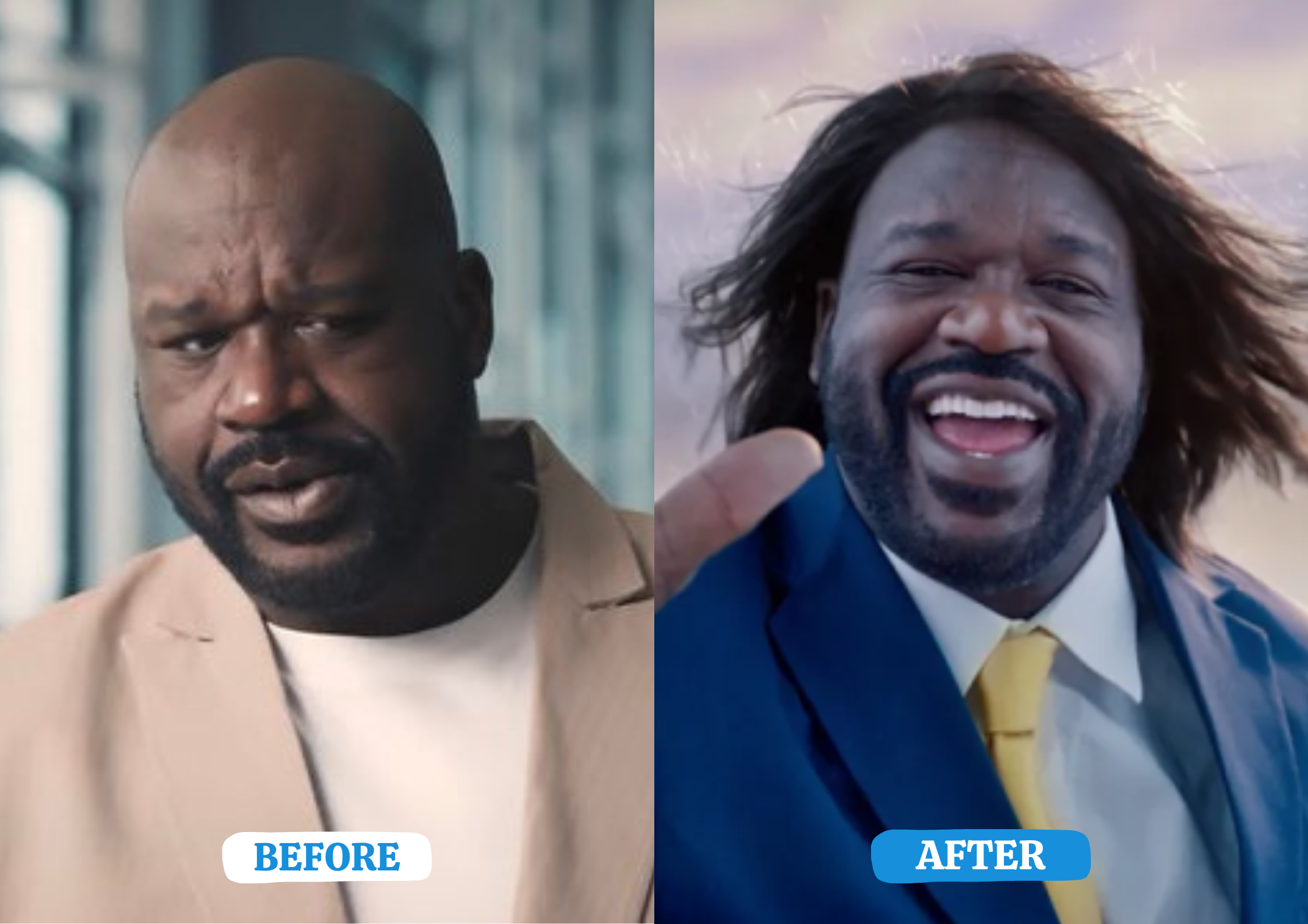 Did Shaquille O’Neal Get a Hair Transplant in Turkey?